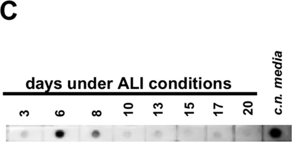 Dot Blot: MUC5AC Antibody (45M1) [NBP2-15196] - Mucin MUC5AC expression & immunoreactivity in primary cells of the nasal cavity. (A) Transcription analysis (RT-PCR) of MUC5AC gene in olfactory epithelial primary cells (OEPC), respiratory epithelial primary cells (REPC), tumour cell line RPMI 2650 & the concha nasalis media (c.n. media). MUC5AC transcript signal was referenced to beta-actin transcript signal. The significance was calculated by comparison of the OEPC, REPC & RPMI 2650 data with the c.n. media transcription data using an unpaired t-test. * p < 0.05; n = 4; error bars represent mean ± SD. (B) Dot blot analysis of MUC5AC protein in lysates of OEPC, REPC, RPMI 2650 & c.n. media. All OEPC & REPC cultures shown in (A,B) were cultivated for 14 days in vitro in T flasks. (C) Immunoreactivity against MUC5AC in OEPC that were first cultured for 7 days in T flask with a minimum confluency of 70% then under ALI conditions additional 20 days. Apically secreted mucus was collected at the days indicated corresponding to a mucin production of 2 to 3 days. Statistical analysis: unpaired t-test, * p < 0.05 compared to the standard model RPMI 2650. Image collected & cropped by CiteAb from the following publication (//pubmed.ncbi.nlm.nih.gov/31374872), licensed under a CC-BY license. Not internally tested by Novus Biologicals.