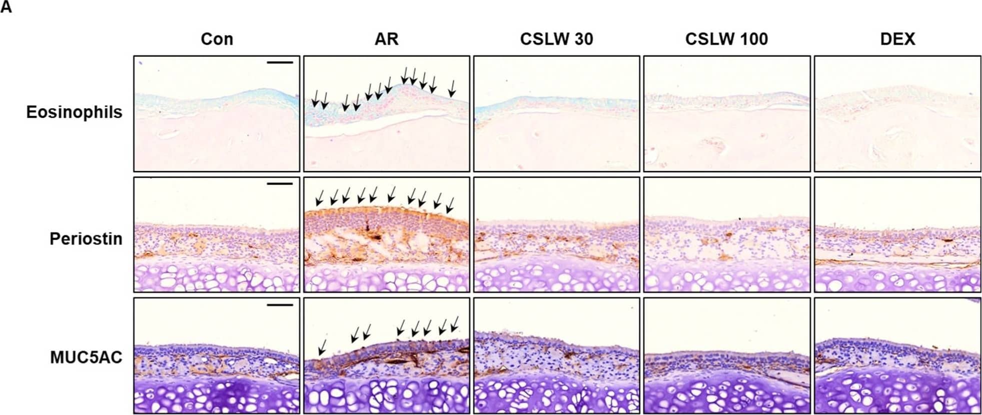 Effect of CSLW on histopathological changes in the nasal tissues. (A) Eosinophils stain via Giemsa staining. Infiltration of the eosinophils (stained bright red); the black arrow indicates the eosinophil (scale bar = 50 μm). Immunohistochemical staining for periostin (A, middle), MUC5AC (A, lower), and 4-HNE (B). Periostin (arrows indicate allergic inflammation, scale bar = 50 μm), MUC5AC (arrows indicate mucus production, scale bar = 50 μm), and 4-HNE (arrows indicate oxidative damage, scale bar = 20 μm) are stained brown. AR, allergic rhinitis; OVA, ovalbumin; CSLW, Caesalpinia sappan Linn. heartwood water extract; DEX, dexamethasone. Image collected and cropped by CiteAb from the following open publication (//pubmed.ncbi.nlm.nih.gov/36421442), licensed under a CC-BY license. Not internally tested by Novus Biologicals.