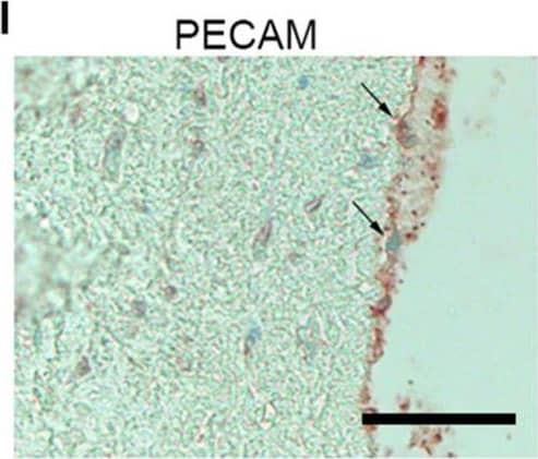 PFKFB3 expression is increased in advanced atherosclerotic plaques and correlates with CD68+ macrophages and necrotic core area. (A,B) Increased expression of PFKFB3 (green) in atheromatous plaques compared with fibrous carotid plaques. n = 10 for fibrous and fibroatheromatous plaques, n = 8 for atheromatous plaques; one-way ANOVA, P = 0.0078 for fibrous vs. atheromatous plaques. Scale bar 50 μm. (A,C) CD68+ macrophages (red) increased in atheromatous carotid plaques. n = 10 for fibrous and fibroatheromatous plaques, n = 8 for atheromatous plaques; one-way ANOVA, P = 0.0008 for fibrous vs. atheromatous plaques. Scale bar 50 μm (D) PFKFB3 expression and CD68 expression correlated significantly. n = 28; linear regression analysis, R2 = 0.7456, P < 0.0001. (E) Human coronary atherosclerotic advanced plaques showed increased PFKFB3 expression compared to initial plaques. n = 4 for initial vs. n = 5 for advanced plaques; two-tailed unpaired Mann-Whitney, P = 0.0317. Scale bar 200 μm. (F) PFKFB3 expression positively correlated with necrotic core area. n = 9; Linear regression analysis R2 = 0.4861, P = 0.0368. (G) Immunohistochemistry of PFKFB3+ co-staining with CD68+ macrophages; Scale bar 100 μm, (H) PECAM+ endothelial cells; Scale bar 100 μm, (I) CD3+ T cells; Scale bar 100 μm, and (J) and  alpha  smooth muscle actin ( alpha SMA)+ vascular smooth muscle cells (K); Scale bar 100 μm. Data are shown as mean +/- standard error of the mean. *P < 0.05, **P ≤ 0.005, ***P < 0.0005. PFKFB3, 6-phophofructo-2-kinase/fructose-2,6-biphosphatase 3; PECAM, platelet endothelial cell adhesion molecule;  alpha SMA. Image collected and cropped by CiteAb from the following open publication (//pubmed.ncbi.nlm.nih.gov/33282864), licensed under a CC-BY license. Not internally tested by Novus Biologicals.