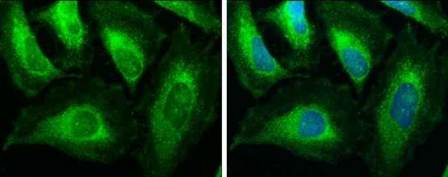 Immunocytochemistry/ Immunofluorescence: ACAA1 Antibody [NBP2-15233] - ACAA1 antibody detects ACAA1 protein at cytoplasm by immunofluorescent analysis.Sample: HeLa cells were fixed in ice-cold MeOH for 5 min.Green: ACAA1 protein stained by ACAA1 antibody (NBP2-15233) diluted at 1:250.Blue: Hoechst 33342 staining.