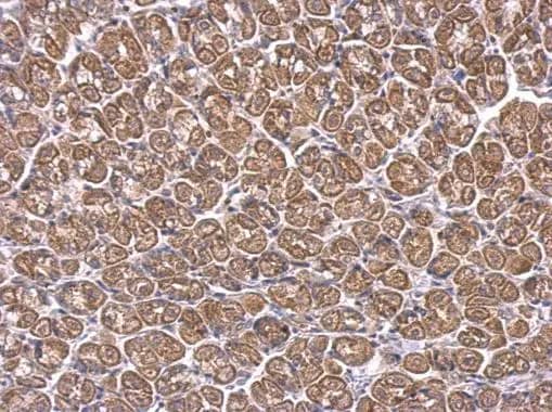 Immunohistochemistry: ACAA1 Antibody [NBP2-15233] - ACAA1 antibody detects ACAA1 protein at cytosol on mouse stomach by immunohistochemical analysis. Sample: Paraffin-embedded mouse stomach. ACAA1 antibody (NBP2-15233) dilution: 1:500.Antigen Retrieval: Trilogy™ (EDTA based, pH 8.0) buffer, 15min