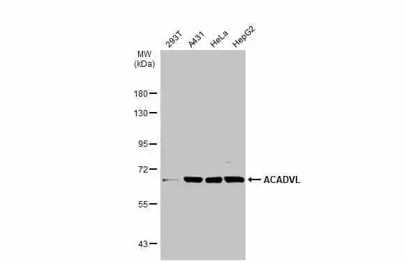 Various whole cell extracts (30 ug) were separated by 7.5% SDS-PAGE, and the membrane was blotted with ACADVL antibody [N1C1] (NBP2-15238) diluted at 1:1000. The HRP-conjugated anti-rabbit IgG antibody  was used to detect the primary antibody. 