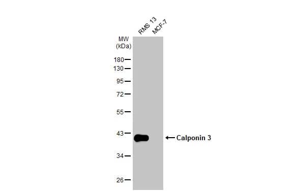 Western Blot: Acidic Calponin Antibody [NBP2-15242] - Various whole cell extracts (30 ug) were separated by 10% SDS-PAGE, and the membrane was blotted with Acidic Calponin antibody (NBP2-15242) diluted at 1:1000. The HRP-conjugated anti-rabbit IgG antibody  was used to detect the primary antibody.