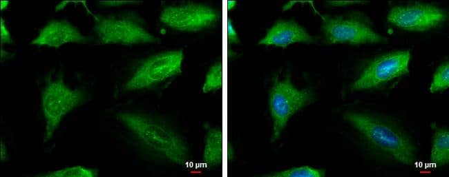Aconitase 1 antibody [N1C1] detects Aconitase 1 protein at cytoplasm by immunofluorescent analysis.Sample: HeLa cells were fixed in ice-cold MeOH for 5 min.Green: Aconitase 1 protein stained by Aconitase 1 antibody [N1C1] (NBP2-15244) diluted at 1:500.Blue: Hoechst 33342 staining.Scale bar = 10 um. 