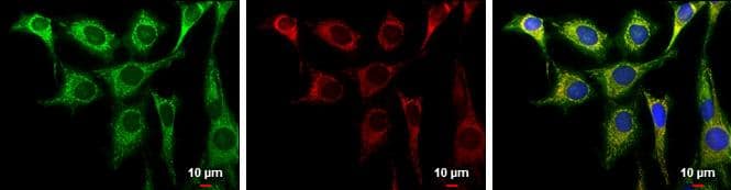 Aconitase 2 antibody [N1N3] detects Aconitase 2 protein at mitochondria by immunofluorescent analysis.Sample: HeLa cells were fixed in 2% paraformaldehyde/culture medium at 37oC for 30 min.Green: Aconitase 2 protein stained by Aconitase 2 antibody [N1N3] (NBP2-15245) diluted at 1:1000.Red: MitoTrackerR Red CMXRos, a mitochondria tracker.Blue: Hoechst 33342 staining.Scale bar = 10 um. 