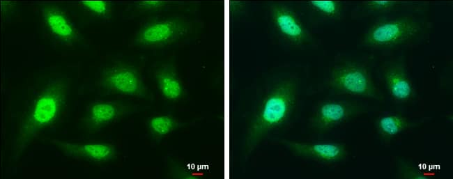 Immunocytochemistry/ Immunofluorescence: CapG Antibody [NBP2-15259] - CapG antibody [N3C3] detects CapG protein at cytoplasm and nucleus by immunofluorescent analysis.Sample: HeLa cells were fixed in 4% paraformaldehyde at RT for 15 min.Green: CapG protein stained by CapG antibody [N3C3] (NBP2-15259) diluted at 1:400.Blue: Hoechst 33342 staining.Scale bar = 10 um.