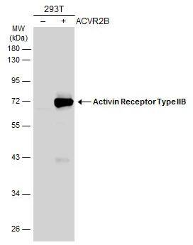 Non-transfected (-) and transfected (+) 293T whole cell extracts (30 ug) were separated by 10% SDS-PAGE, and the membrane was blotted with Activin Receptor Type IIB antibody [N1C1] (NBP2-15268) diluted at 1:25000. The HRP-conjugated anti-rabbit IgG antibody  was used to detect the primary antibody. 