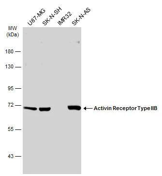 Various whole cell extracts (30 ug) were separated by 7.5% SDS-PAGE, and the membrane was blotted with Activin Receptor Type IIB antibody [N1C1] (NBP2-15268) diluted at 1:1000. The HRP-conjugated anti-rabbit IgG antibody  was used to detect the primary antibody. 