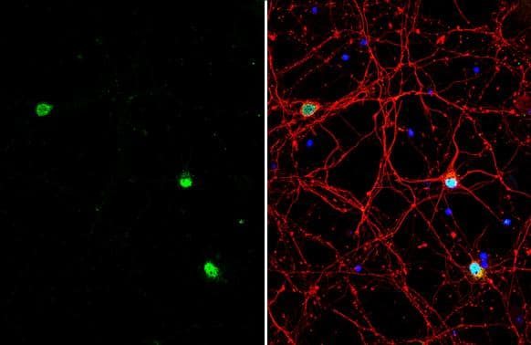 BAF53B antibody detects BAF53B protein by immunofluorescent analysis.Sample: DIV9 rat E18 primary cortical neuron cells were fixed in 4% paraformaldehyde at RT for 15 min.Green: BAF53B stained by BAF53B antibody (NBP2-15269) diluted at 1:500.Red: beta Tubulin 3/ Tuj1, stained by beta Tubulin 3/ Tuj1 antibody [GT11710]  diluted at 1:500.Blue: Fluoroshield with DAPI . 