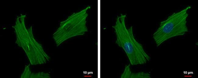Immunocytochemistry/ Immunofluorescence ACTR1B Antibody - BSA Free