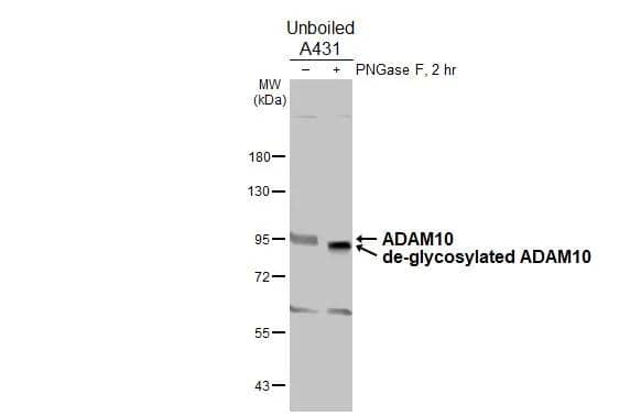 Untreated (-) and treated (+) unboiled A431 whole cell extracts (30 ug) were separated by 7.5% SDS-PAGE, and the membrane was blotted with ADAM10 antibody [N2C1], Internal (NBP2-15280) diluted at 1:1000. The HRP-conjugated anti-rabbit IgG antibody  was used to detect the primary antibody. 
