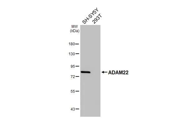 Western Blot ADAM22 Antibody - BSA Free