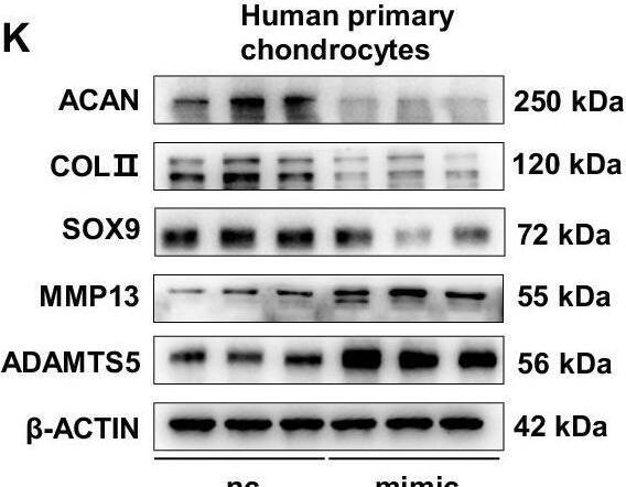 MiR-23b-3p was the key mediator of osteocyte-derived extracellular vesicles in regulating cartilage metabolism.A A schematic diagram illustrating the separation of extracellular vesicles (EVs) and their enrichment from human tissues and mouse plasma. Heatmaps of relative miRNA differences (B) and enrichment analysis (C). D The miR-23b-3p levels in LS-EVs and HS-EVs (n = 5). E The miR-23b-3p levels in subchondral bone (SCB) osteocytes from WT and Dicer-cKO mice with destabilization of the medial meniscus (DMM) surgery (n = 5). F The miR-23b-3p levels in cartilage and SCB osteocytes from human LS/HS tissues (n = 20). G The miR-23b-3p levels in cartilage and SCB osteocytes from mice with DMM surgery (n = 6). H The pre-miR-23b-3p levels in cartilage and SCB osteocytes from human LS/HS tissues (n = 20). I The pre-miR-23b-3p levels in cartilage and SCB osteocytes from mice with DMM surgery (n = 6). J Alcian blue staining. Scale bar in upper panel, 1 mm. Scale bar in lower panel, 2 mm. K Western blot analysis of COLII, ACAN, SOX9, MMP13 and ADAMTS5 protein expression in primary human and mouse chondrocytes transfected with nc or mimic (n = 3). L The schematic depicted the overexpression of miR-23b-3p in cartilage through intraarticular injection of rAAV5-miR-23b-3p-mcherry (rAAV5-miR-23b-3p) or negative control (rAAV5-nc) in 8-week-old male mice following DMM surgery (n = 8). M The Safranin O images of cartilage. Scale bar in upper panel, 200 μm. Scale bar in lower panel, 100 μm. Data are presented as the mean +/- SD. Data was analyzed by unpaired two-tailed Student’s t-test (D, E, G, I and K) and paired two-tailed Student’s t-test (F and H). Source data are provided as a Source Data file. Image collected and cropped by CiteAb from the following open publication (//pubmed.ncbi.nlm.nih.gov/40399261), licensed under a CC-BY license. Not internally tested by Novus Biologicals.