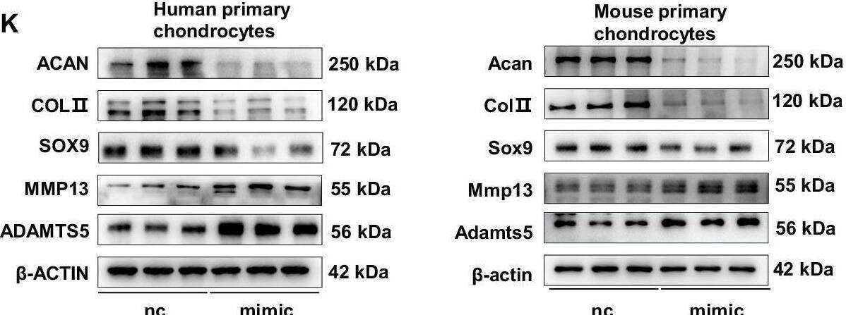 MiR-23b-3p was the key mediator of osteocyte-derived extracellular vesicles in regulating cartilage metabolism.A A schematic diagram illustrating the separation of extracellular vesicles (EVs) and their enrichment from human tissues and mouse plasma. Heatmaps of relative miRNA differences (B) and enrichment analysis (C). D The miR-23b-3p levels in LS-EVs and HS-EVs (n = 5). E The miR-23b-3p levels in subchondral bone (SCB) osteocytes from WT and Dicer-cKO mice with destabilization of the medial meniscus (DMM) surgery (n = 5). F The miR-23b-3p levels in cartilage and SCB osteocytes from human LS/HS tissues (n = 20). G The miR-23b-3p levels in cartilage and SCB osteocytes from mice with DMM surgery (n = 6). H The pre-miR-23b-3p levels in cartilage and SCB osteocytes from human LS/HS tissues (n = 20). I The pre-miR-23b-3p levels in cartilage and SCB osteocytes from mice with DMM surgery (n = 6). J Alcian blue staining. Scale bar in upper panel, 1 mm. Scale bar in lower panel, 2 mm. K Western blot analysis of COLII, ACAN, SOX9, MMP13 and ADAMTS5 protein expression in primary human and mouse chondrocytes transfected with nc or mimic (n = 3). L The schematic depicted the overexpression of miR-23b-3p in cartilage through intraarticular injection of rAAV5-miR-23b-3p-mcherry (rAAV5-miR-23b-3p) or negative control (rAAV5-nc) in 8-week-old male mice following DMM surgery (n = 8). M The Safranin O images of cartilage. Scale bar in upper panel, 200 μm. Scale bar in lower panel, 100 μm. Data are presented as the mean +/- SD. Data was analyzed by unpaired two-tailed Student’s t-test (D, E, G, I and K) and paired two-tailed Student’s t-test (F and H). Source data are provided as a Source Data file. Image collected and cropped by CiteAb from the following open publication (//pubmed.ncbi.nlm.nih.gov/40399261), licensed under a CC-BY license. Not internally tested by Novus Biologicals.