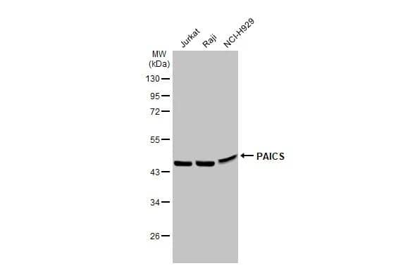 Various tissue extracts (30 ug) were separated by 10% SDS-PAGE, and the membrane was blotted with PAICS antibody (NBP2-15289) diluted at 1:1000. The HRP-conjugated anti-rabbit IgG antibody  was used to detect the primary antibody. 