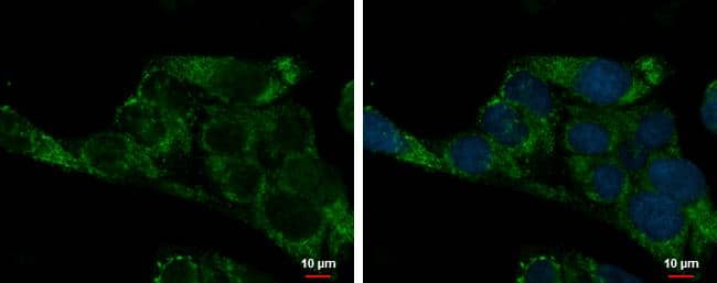 ADHFE1 antibody [N1C1] detects ADHFE1 protein at mitochondria by immunofluorescent analysis.Sample: Hep G2 cells were fixed in 2% paraformaldehyde/culture medium at 37oC for 30 min.Green: ADHFE1 protein stained by ADHFE1 antibody [N1C1] (NBP2-15297) diluted at 1:500.Blue: Hoechst 33342 staining. 