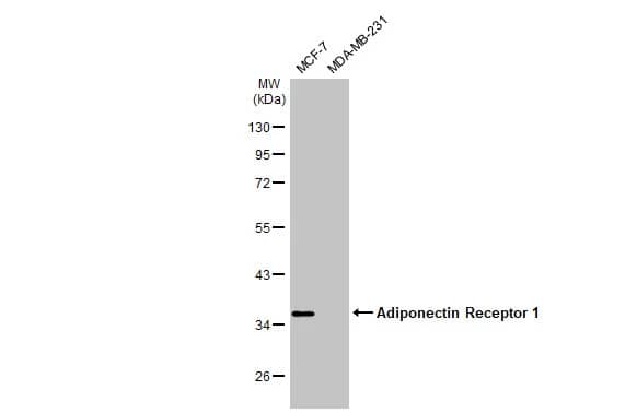 Western Blot: AdipoR1 Antibody [NBP2-15300] - Various whole cell extracts (30 ug) were separated by 10% SDS-PAGE, and the membrane was blotted with AdipoR1 antibody [C2C3], C-term (NBP2-15300) diluted at 1:1000. The HRP-conjugated anti-rabbit IgG antibody  was used to detect the primary antibody.