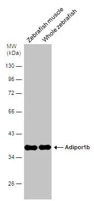 Western Blot: AdipoR1 Antibody [NBP2-15300] - Various tissue extracts (30 ug) were separated by 10% SDS-PAGE, and the membrane was blotted with AdipoR1 antibody [C2C3], C-term (NBP2-15300) diluted at 1:500.