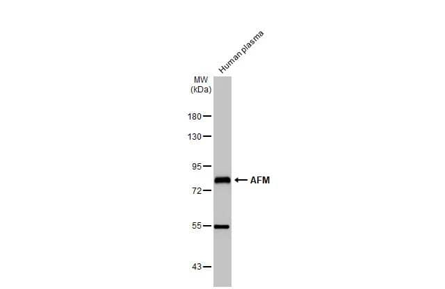 Human plasma was separated by 7.5% SDS-PAGE, and the membrane was blotted with AFM antibody (NBP2-15304) diluted at 1:10000. The HRP-conjugated anti-rabbit IgG antibody  was used to detect the primary antibody. 