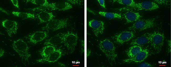 Adenylate kinase 4 antibody [N1C3-2] detects Adenylate kinase 4 protein at mitochondria by immunofluorescent analysis.Sample: SKNSH cells were fixed in 2% paraformaldehyde/culture medium at 37oC for 30 min.Green: Adenylate kinase 4 protein stained by Adenylate kinase 4 antibody [N1C3-2] (NBP2-15317) diluted at 1:500.Blue: Hoechst 33342 staining.Scale bar = 10 um. 