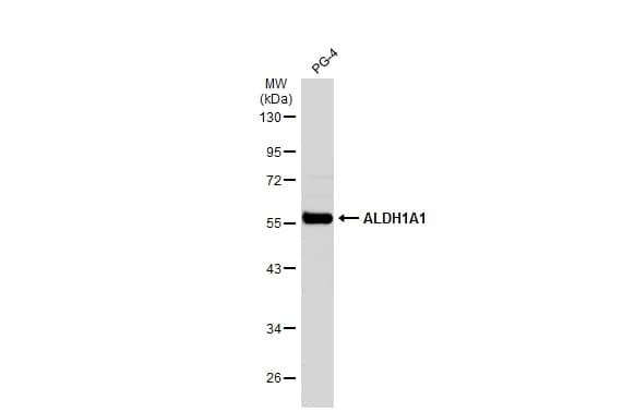 Western Blot: Aldehyde Dehydrogenase 1-A1/ALDH1A1 Antibody [NBP2-15334] - PG-4 whole cell extract (30 ug) was separated by 10% SDS-PAGE, and the membrane was blotted with Aldehyde Dehydrogenase 1-A1/ALDH1A1 antibody (NBP2-15334) diluted at 1:5000. The HRP-conjugated anti-rabbit IgG antibody  was used to detect the primary antibody.