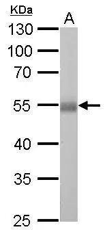ALDH1A1 antibody detects ALDH1A1 protein by western blot analysis.A. 50 ug rat liver lysate/extract10% SDS-PAGEALDH1A1 antibody (NBP2-15334) dilution: 1:5000 The HRP-conjugated anti-rabbit IgG antibody  was used to detect the primary antibody. 