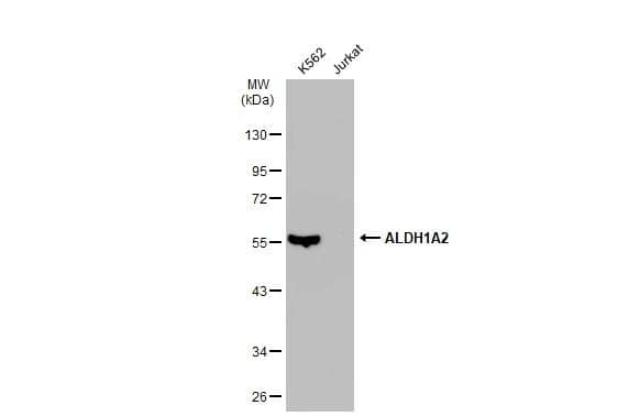 Various whole cell extracts (30 ug) were separated by 10% SDS-PAGE, and the membrane was blotted with ALDH1A2 antibody [N1N3] (NBP2-15338) diluted at 1:1000. The HRP-conjugated anti-rabbit IgG antibody  was used to detect the primary antibody. 