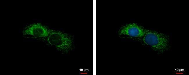 ALDH7A1 antibody detects ALDH7A1 protein at mitochondria by immunofluorescent analysis.Sample: HepG2 cells were fixed in 2% paraformaldehyde/culture medium at 37C for 30 min.Green: ALDH7A1 protein stained by ALDH7A1 antibody (NBP2-15342) diluted at 1:500.Blue: Hoechst 33342 staining. 