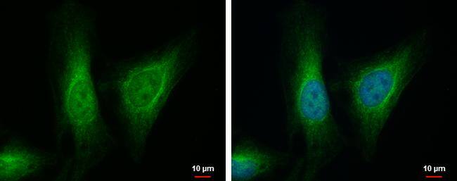 ALDH7A1 antibody [C1C3] detects ALDH7A1 protein at mitochondria and nucleus by immunofluorescent analysis.Sample: HeLa cells were fixed in 2% paraformaldehyde/culture medium at 37C for 30 min.Green: ALDH7A1 protein stained by ALDH7A1 antibody [C1C3] (NBP2-15343) diluted at 1:500.Blue: Hoechst 33342 staining. 