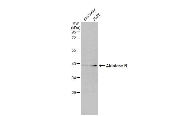 Western Blot Aldolase B Antibody - BSA Free
