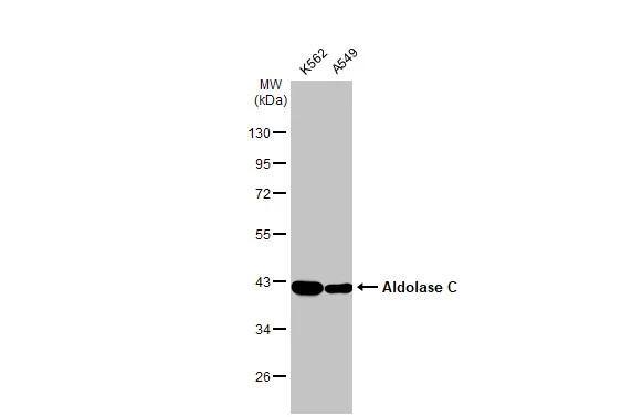 Various whole cell extracts (30 ug) were separated by 10% SDS-PAGE, and the membrane was blotted with Aldolase C antibody [N1C1] (NBP2-15346) diluted at 1:1000. The HRP-conjugated anti-rabbit IgG antibody  was used to detect the primary antibody. 