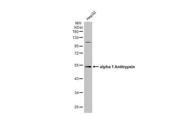 Whole cell extract (30 ug) was separated by 10% SDS-PAGE, and the membrane was blotted with alpha 1 Antitrypsin antibody [N1C2] (NBP2-15349) diluted at 1:1000. The HRP-conjugated anti-rabbit IgG antibody  was used to detect the primary antibody. 