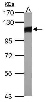 Western Blot: Alpha Actinin 3 Antibody [NBP2-15356] - Sample (30 ug of whole cell lysate)  A: whole zebrafish   7.5% SDS PAGE  NBP2-15356 diluted at 1:1000 