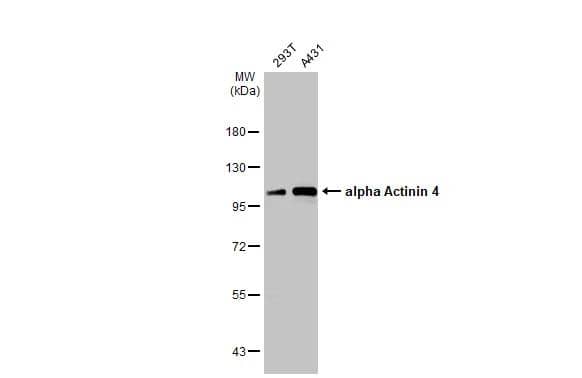 Various whole cell extracts (30 ug) were separated by 7.5% SDS-PAGE, and the membrane was blotted with alpha Actinin 4 antibody [C2C3], C-term (NBP2-15357) diluted at 1:1000. The HRP-conjugated anti-rabbit IgG antibody  was used to detect the primary antibody. 