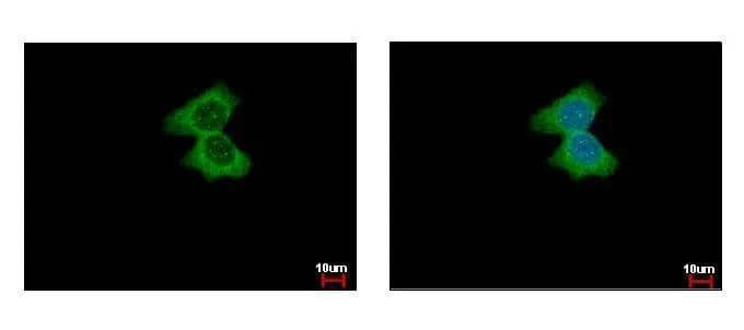 alpha Actinin 4 antibody [N1N2], N-term detects ACTN4 protein at cytoplasm by immunofluorescent analysis. Sample: MCF-7 cells were fixed in ice-cold MeOH for 5 min.Green: ACTN4 protein stained by alpha Actinin 4 antibody [N1N2], N-term (NBP2-15358) diluted at 1:500.Blue: Hoechst 33342 staining. 