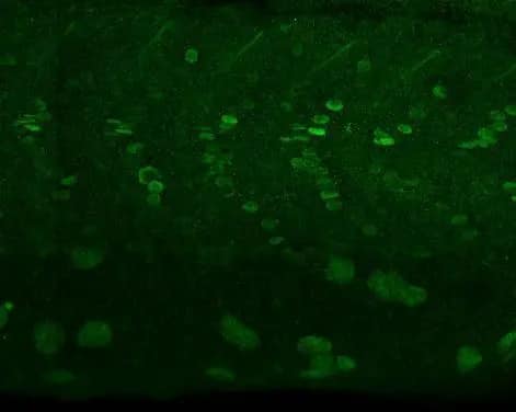 Immunohistochemistry: alpha Adducin Antibody [NBP2-15359] - alpha Adducin antibody [N1N2], N-term detects alpha Adducin protein at nucleus on whole-mount zebrafish embryos by immunohistochemical analysis. Sample: Paraformaldehyde-fixed zebrafish embryos.  alpha Adducin antibody [N1N2], N-term (NBP2-15359) dilution: 1:200.