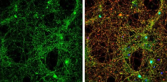 alpha Synuclein antibody detects alpha Synuclein protein by immunofluorescent analysis.Sample: DIV14 rat E18 primary cortical neurons were fixed in 4% paraformaldehyde at RT for 15 min.Green: alpha Synuclein protein stained by alpha Synuclein antibody (NBP2-15365) diluted at 1:500.Red: beta Tubulin 3/ Tuj1, stained by beta Tubulin 3/ Tuj1 antibody [GT1338]  diluted at 1:500.Blue: Fluoroshield with DAPI . 