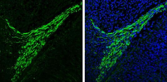 alpha Synuclein antibody detects alpha Synuclein protein expression by immunohistochemical analysis.Sample: Frozen sectioned E13.5 Rat brain. Green: alpha Synuclein protein stained by alpha Synuclein antibody (NBP2-15365) diluted at 1:250.Blue: Fluoroshield with DAPI . 