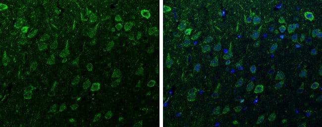 alpha Synuclein antibody detects alpha Synuclein protein at cytoplasm and nucleus in rat brain by immunohistochemical analysis. Sample: Paraffin-embedded rat brain. Green: alpha Synuclein antibody (NBP2-15365) diluted at 1:200. The signal was developed using goat anti-rabbit IgG antibody (Dylight488) .Blue: Nuclear staining with Hoechst 33342. br>Antigen Retrieval: Citrate buffer, pH 6.0, 15 min 