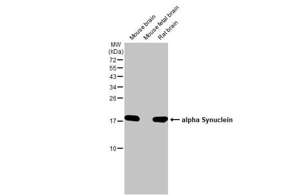 Various tissue extracts (50 ug) were separated by 15% SDS-PAGE, and the membrane was blotted with alpha Synuclein antibody (NBP2-15365) diluted at 1:1000. The HRP-conjugated anti-rabbit IgG antibody  was used to detect the primary antibody. 
