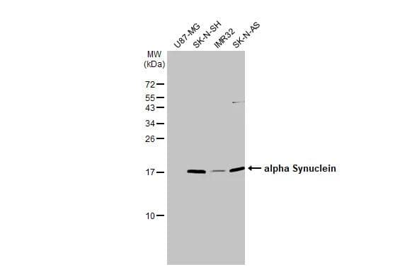 Various whole cell extracts (30 ug) were separated by 15% SDS-PAGE, and the membrane was blotted with alpha Synuclein antibody (NBP2-15365) diluted at 1:1000. The HRP-conjugated anti-rabbit IgG antibody  was used to detect the primary antibody. 