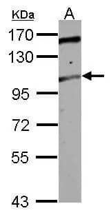 Western Blot ALS2CR3 Antibody