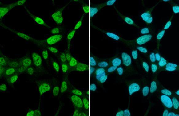 Androgen Receptor antibody [N1], N-term detects Androgen Receptor protein at nucleus by immunofluorescent analysis.Sample: LNCap cells were fixed in 4% paraformaldehyde at RT for 15 min.Green: Androgen Receptor stained by Androgen Receptor antibody [N1], N-term (NBP2-15384) diluted at 1:2000. 