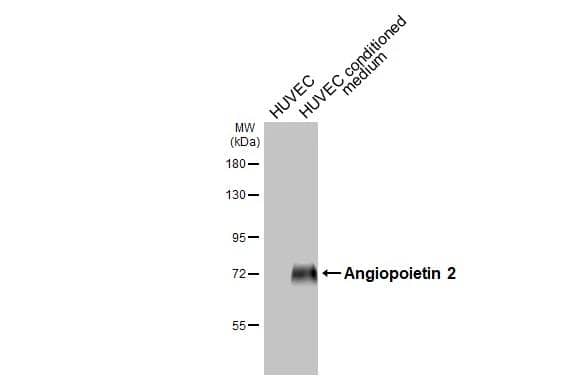 HUVEC whole cell extract and conditioned medium (30 ug) were separated by 7.5% SDS-PAGE, and the membrane was blotted with Angiopoietin 2 antibody (NBP2-15385) diluted at 1:1000. The HRP-conjugated anti-rabbit IgG antibody  was used to detect the primary antibody. 