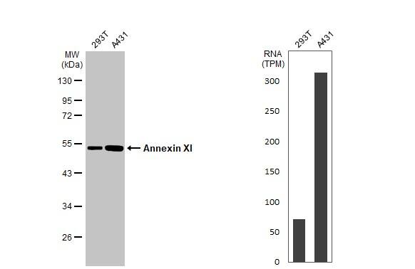 Various whole cell extracts (30 ug) were separated by 10% SDS-PAGE, and the membrane was blotted with Annexin XI antibody (NBP2-15405) diluted at 1:1000. The HRP-conjugated anti-rabbit IgG antibody  was used to detect the primary antibody. Corresponding RNA expression data for the same cell lines are based on Human Protein Atlas program. 
