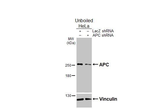 <b>Genetic Strategies Validation. </b>Non-transfected (-) and transfected (+) unboiled HeLa whole cell extracts (30 ug) were separated by 5% SDS-PAGE, and the membrane was blotted with APC antibody [C3], C-term (NBP2-15422) diluted at 1:1000. The HRP-conjugated anti-rabbit IgG antibody  was used to detect the primary antibody. 