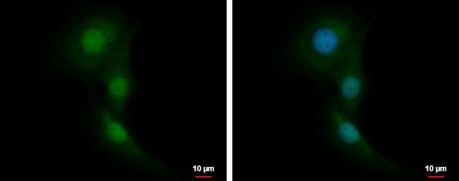 RNF14 antibody [N1C1] detects RNF14 protein at cytoplasm and nucleus by immunofluorescent analysis.Sample: U87-MG cells were fixed in 4% paraformaldehyde at RT for 15 min.Green: RNF14 protein stained by RNF14 antibody [N1C1] (NBP2-15438) diluted at 1:500.Blue: Hoechst 33342 staining.Scale bar = 10 um. 