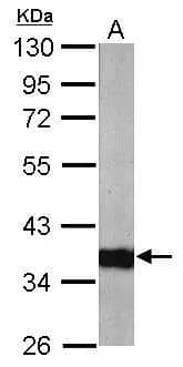Western Blot ARPC1A Antibody - BSA Free