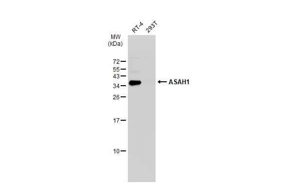 Western Blot: ASAH1 Antibody [NBP2-15479] - Various whole cell extracts (30 ug) were separated by 15% SDS-PAGE, and the membrane was blotted with ASAH1 antibody (NBP2-15479) diluted at 1:1000. The HRP-conjugated anti-rabbit IgG antibody  was used to detect the primary antibody.