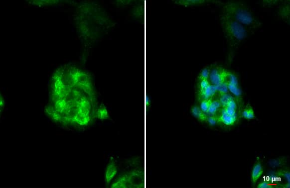 Immunocytochemistry/ Immunofluorescence: ASGPR1 Antibody [NBP2-15489] - ASGPR1 antibody [N1C3] detects ASGPR1 protein at cytoplasm by immunofluorescent analysis.Sample: HepG2 cells were fixed in 4% paraformaldehyde at RT for 15 min.Green: ASGPR1 stained by ASGPR1 antibody [N1C3] (NBP2-15489) diluted at 1:500.Blue: Fluoroshield with DAPI .Scale bar= 10um.